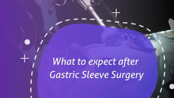 What to expect after a bariatric surgery