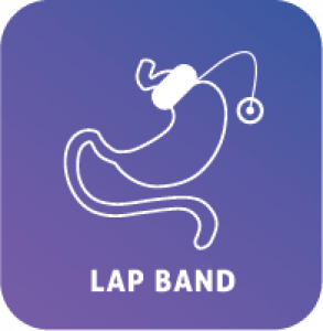 Lap Band revision surgery