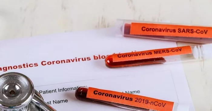 Principal Image Coronavirus disease