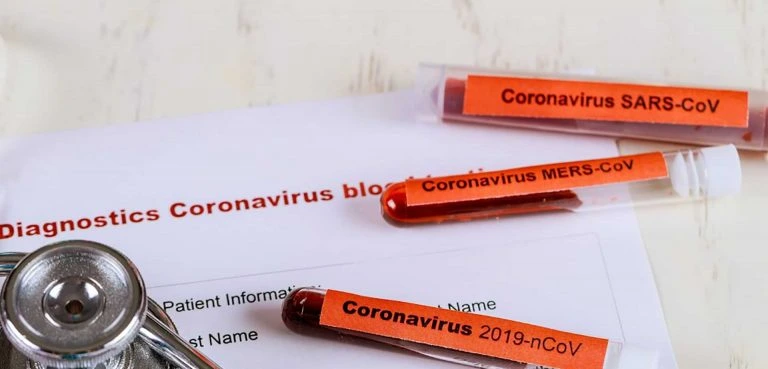 Principal Image Coronavirus disease