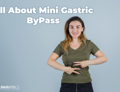 All About you need to know of Mini Gastric Bypass