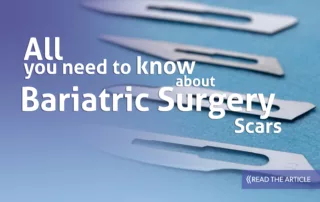 Bariatrcic surgery scars