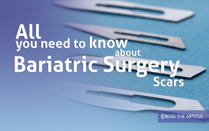 Bariatric Surgery Scars