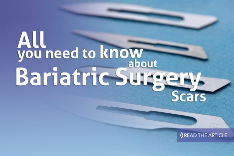 Bariatric Surgery Scars