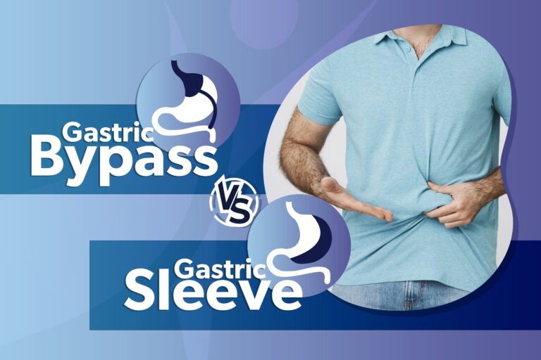 gastric sleeve featured img