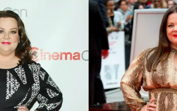 Principal Image of Melissa McCarthy weight loss surgeryf