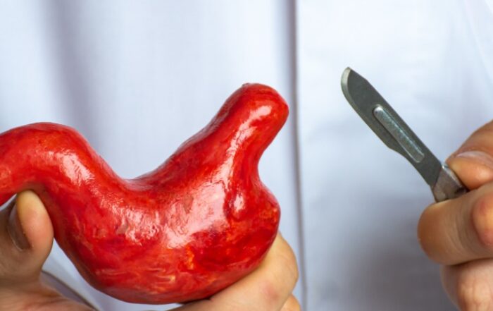 Principal Image of Myths about bariatric surgery