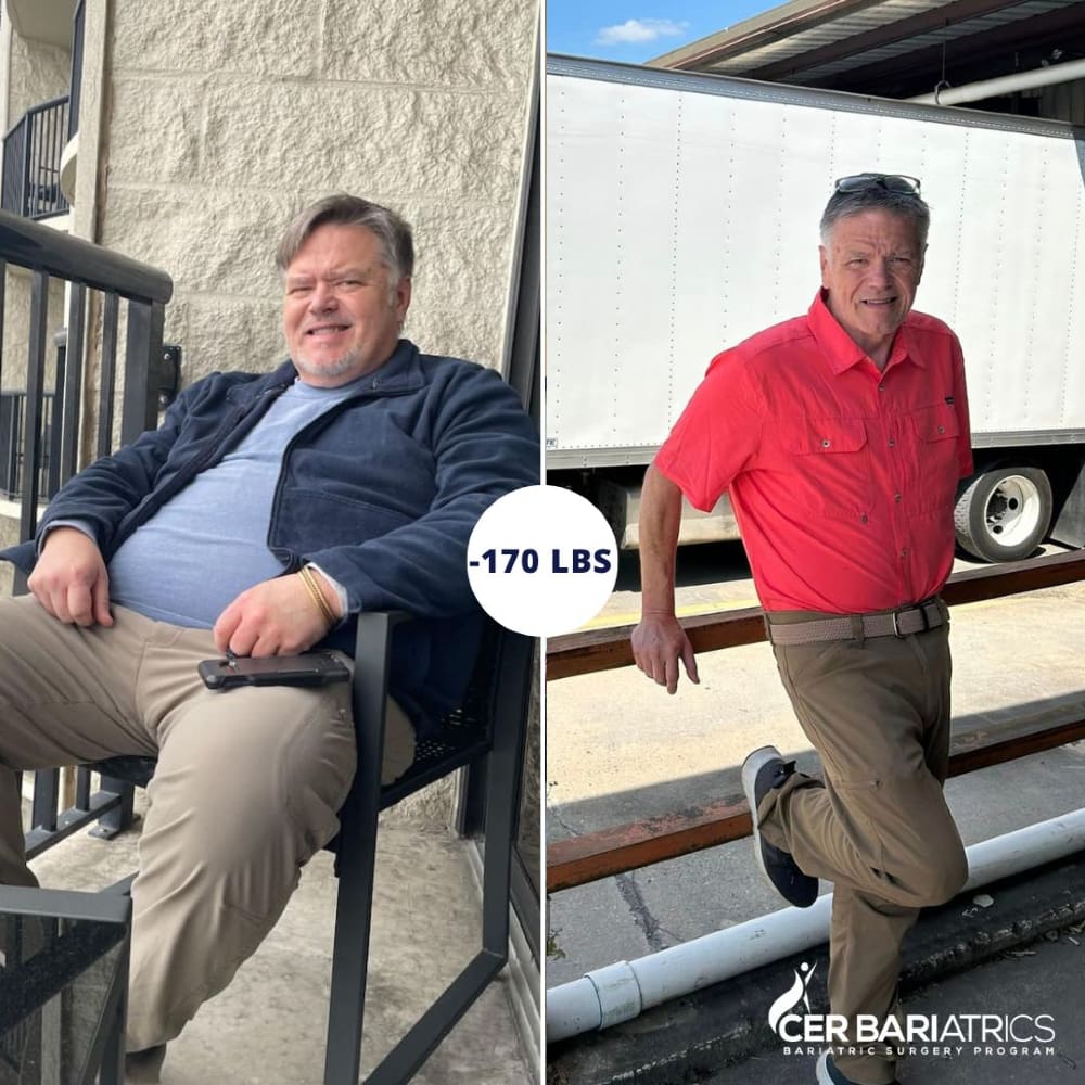 Before and After