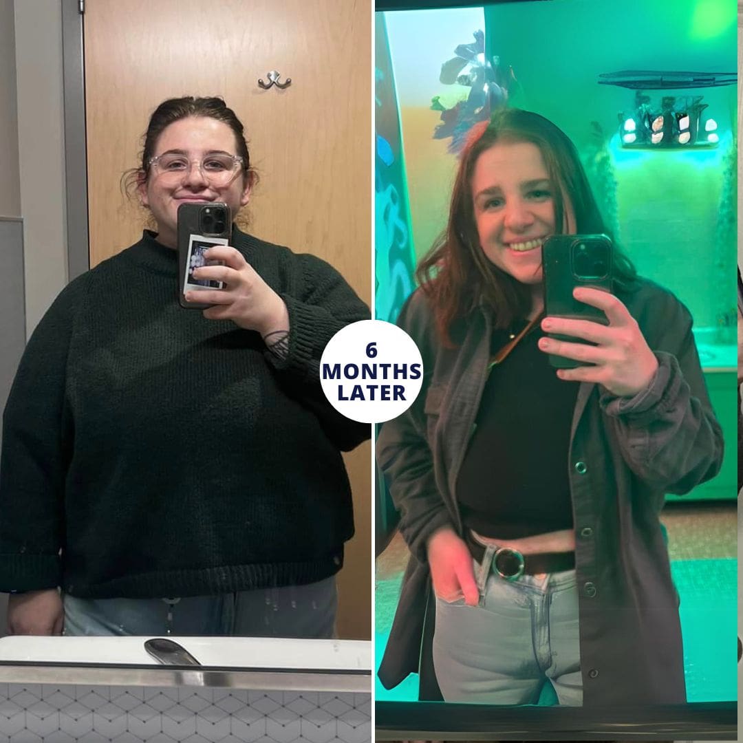 Before and After