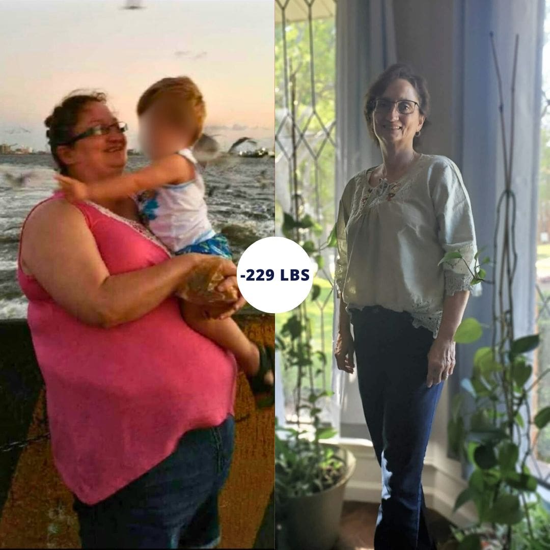 Before and After