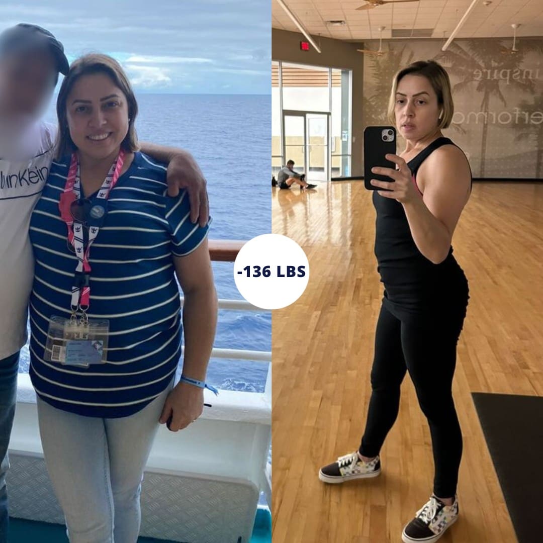Before and After