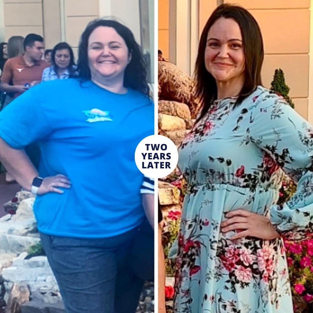 Before and after photo of a patient during the Evaluation Tour at CER Bariatrics.