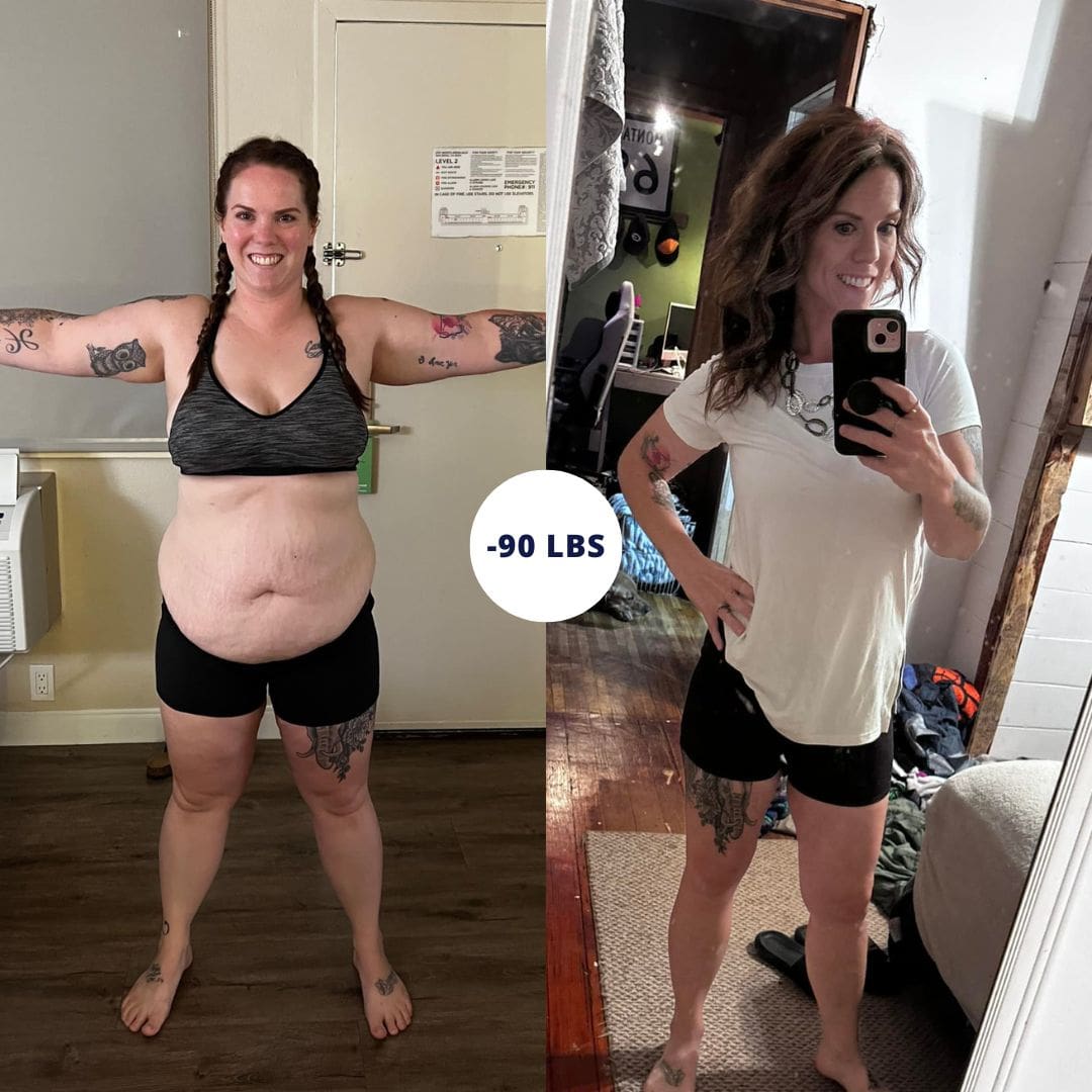 Before and after photo of a patient during the Evaluation Tour at CER Bariatrics.