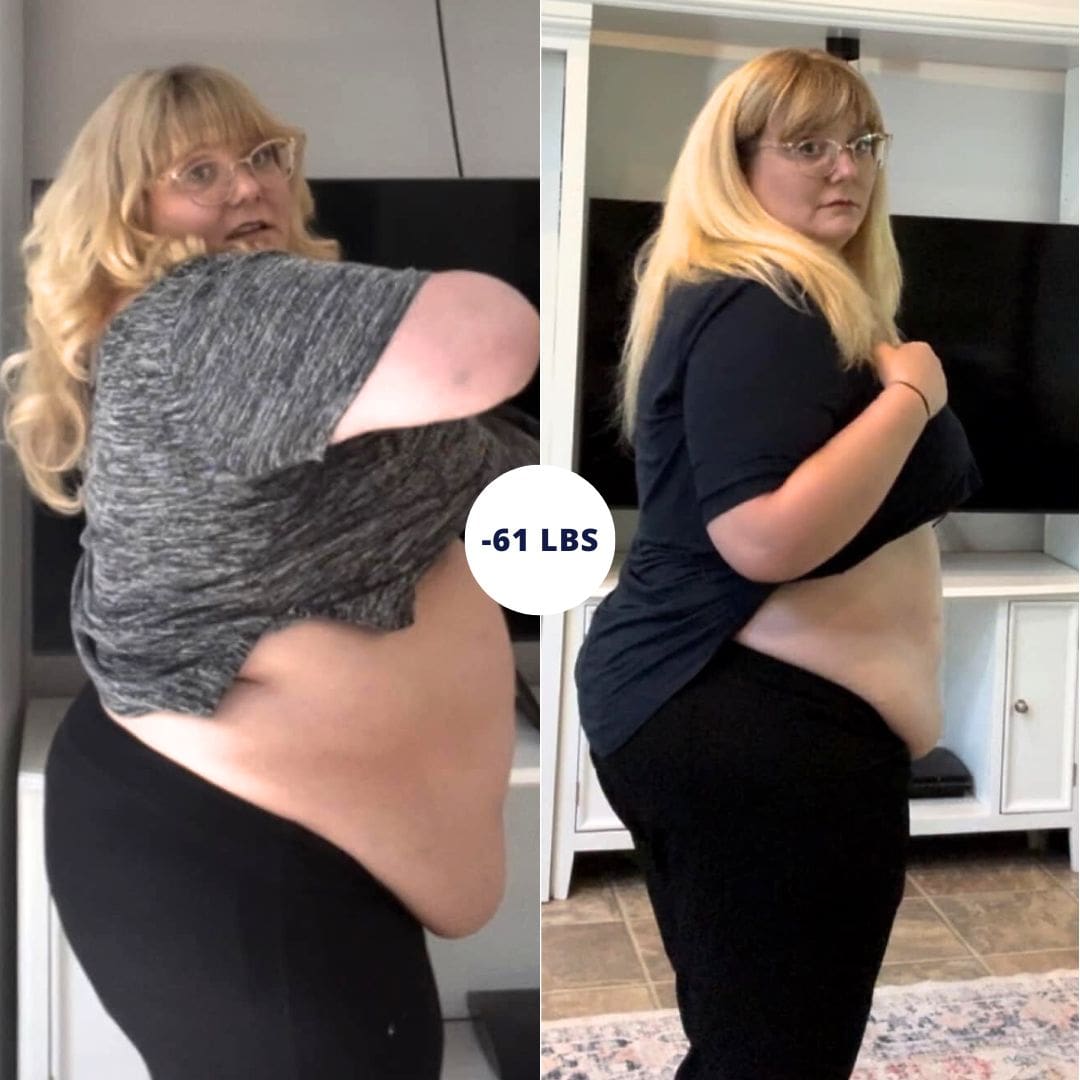 before and after cer bariatrics