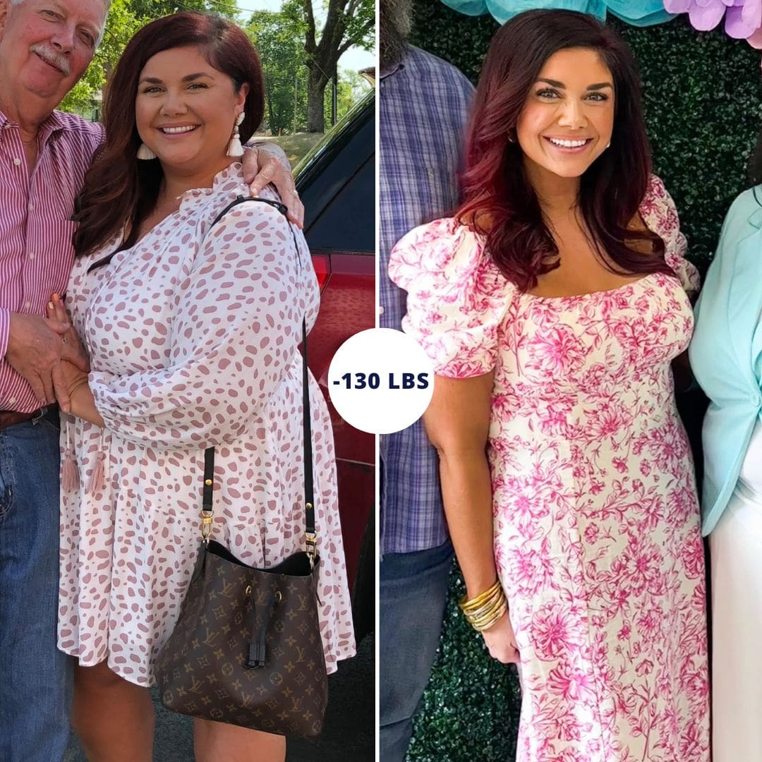 Before and after photo of a patient during the Evaluation Tour at CER Bariatrics.